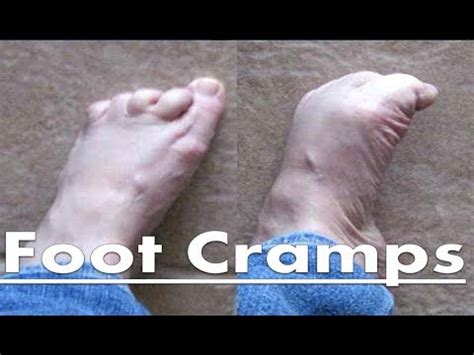 What Causes Toe Cramps At Night